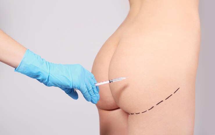 female-buttocks-marked-plastic-operation-doctors-hand-with-syringe-light-background-closeup_392895-564789